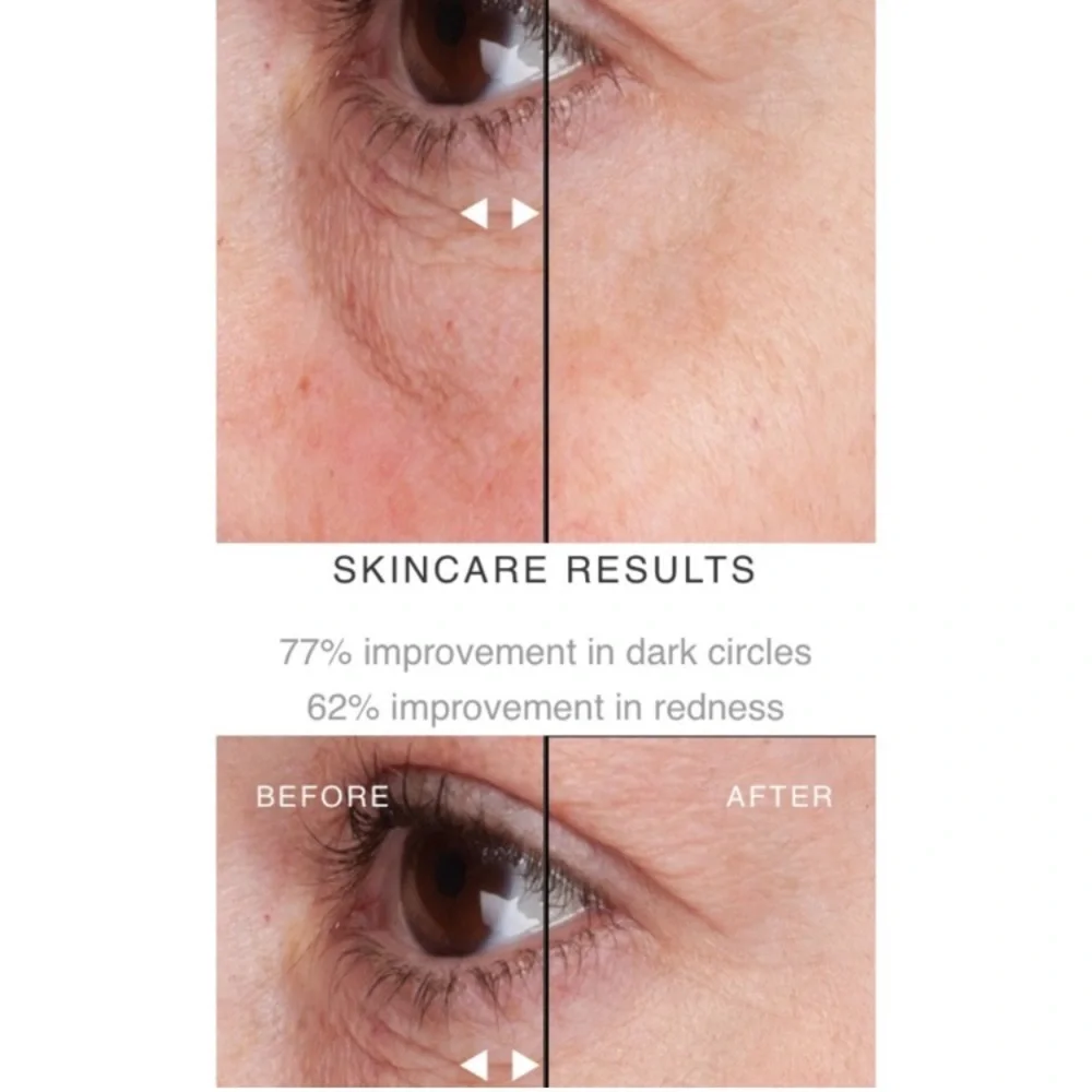Onomie bright concealing